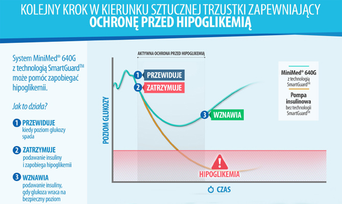 Medtronic ogasza premier systemu MINIMED 640G