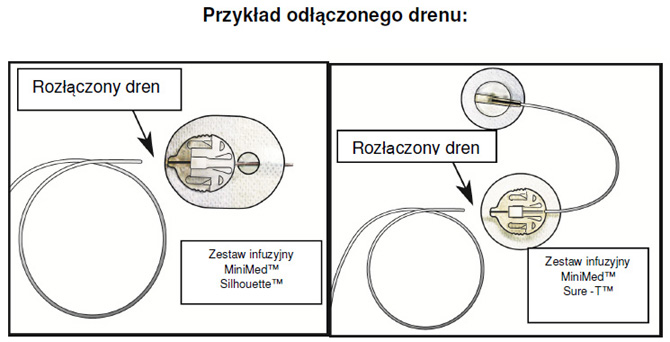 Informacja dla pacjentw: Zestawy infuzyjne Medtronic MiniMed Silhouette oraz Sure-T